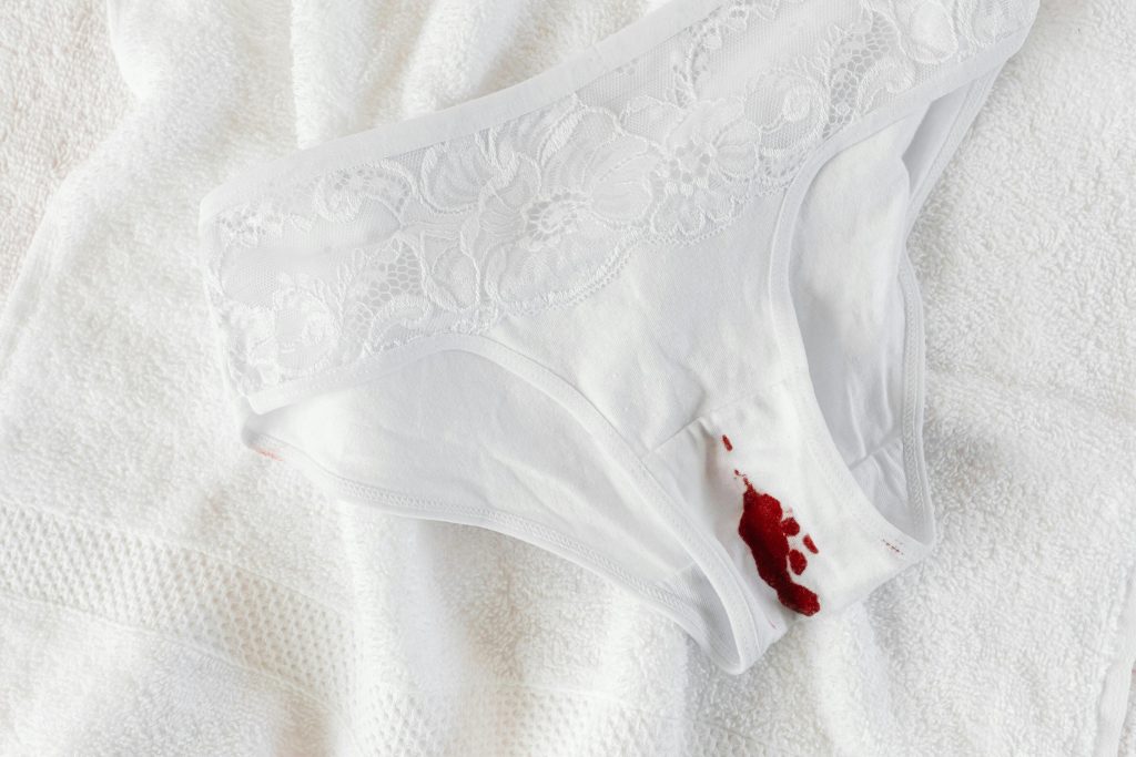 Ropa interior manchada de sangre menstrual sobre unas sábanas blancas